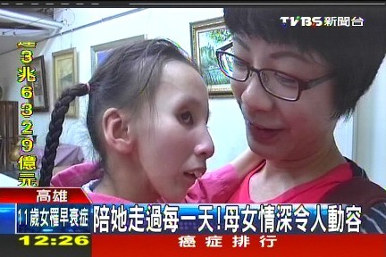 早老症爱女11岁像77岁台湾母亲坚毅呵护（图）