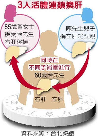 全台首例台北荣总医院完成“3人活体连锁换肝”