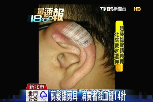 男子被菜鸟理发师剪伤耳朵溅血急缝14针（图）